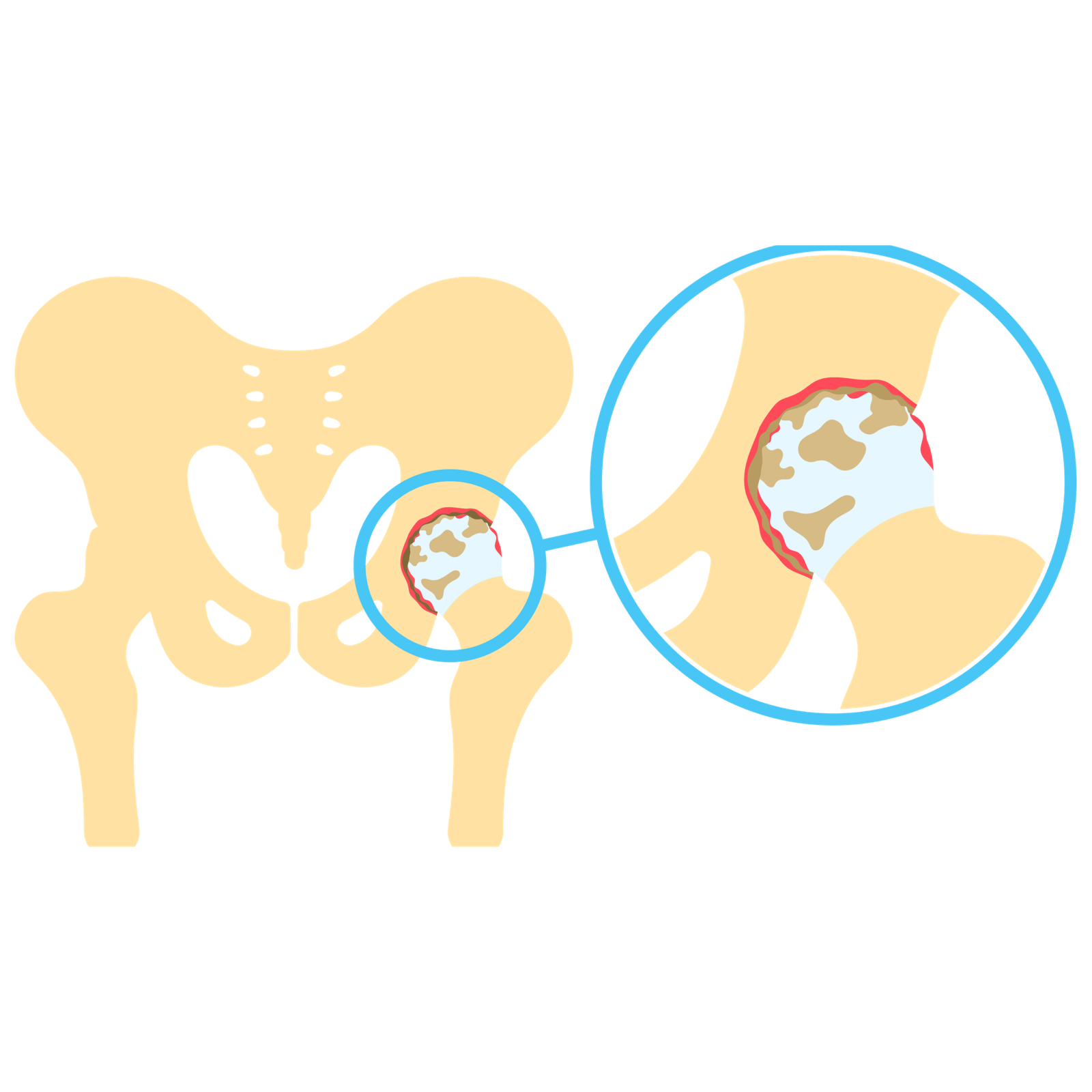 Sciatica Pain Treatment in Tirupati